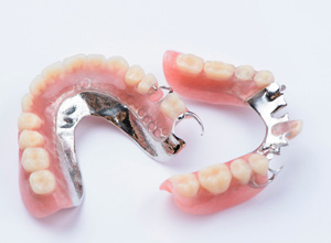 Two partial dentures with metal attachments