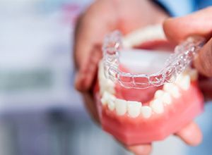 Dental model and clear aligner being used to demonstrate how Invisalign works