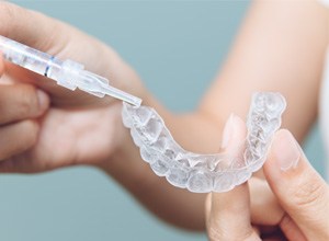 Person placing whitening formula into custom tray